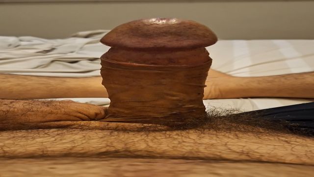 ACORDANDO DE PICAO  TODO ESFOLADAO 