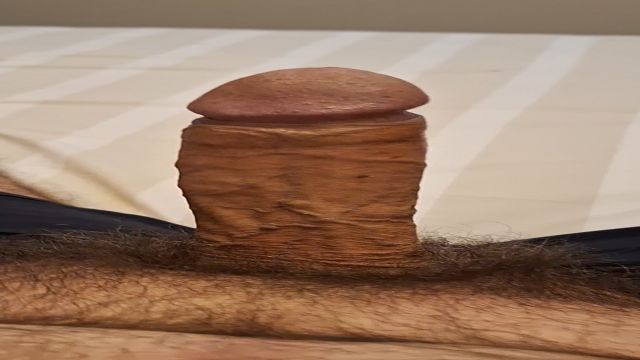 FECHEI MAIS UMA SEMANA ASSIM DE PICAO TODO ESFOLADO 