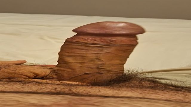 ACORDEI DE PICAO BABANDO E TODO ESFOLADAO 