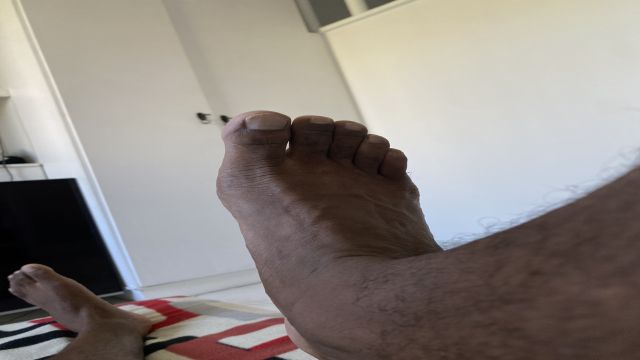 Pé ou pica?