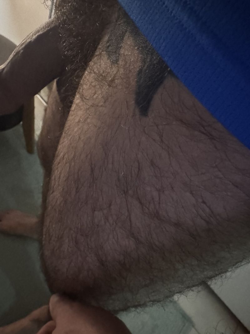 Coxa peluda, quem gosta?