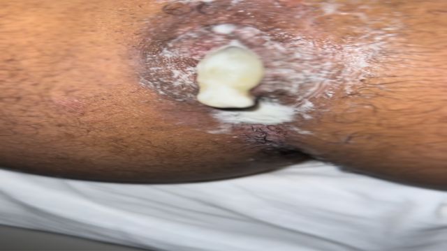 Aventuras no Errejota 