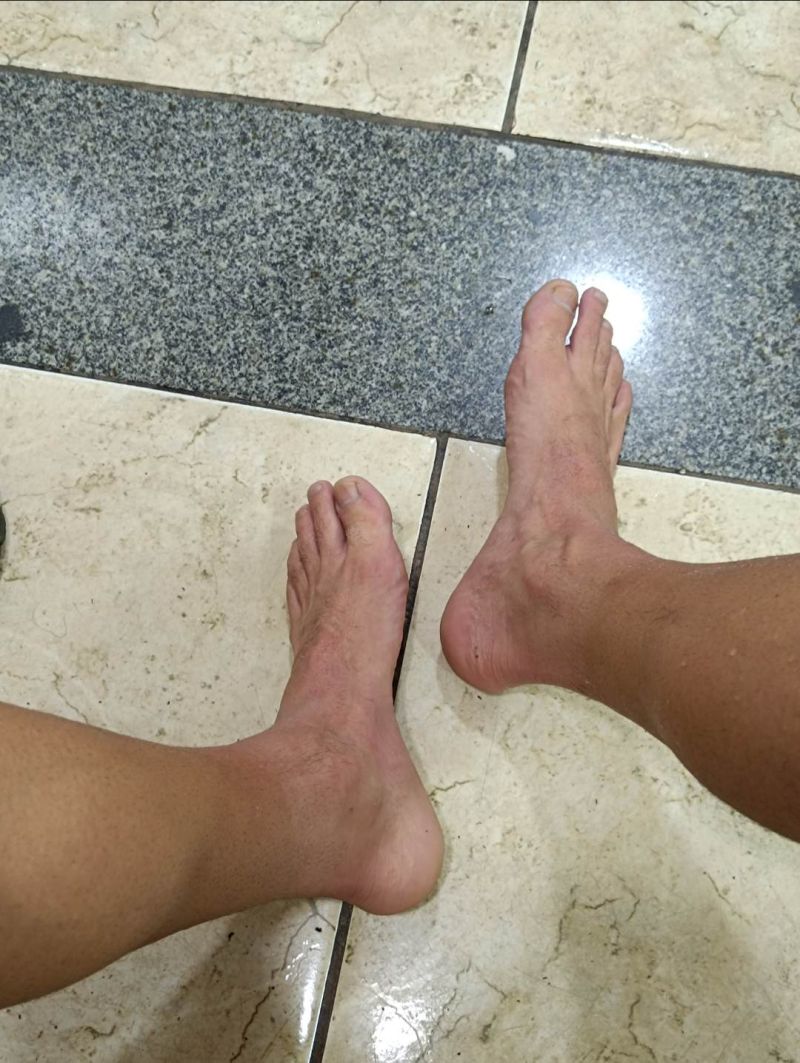 pezinho...