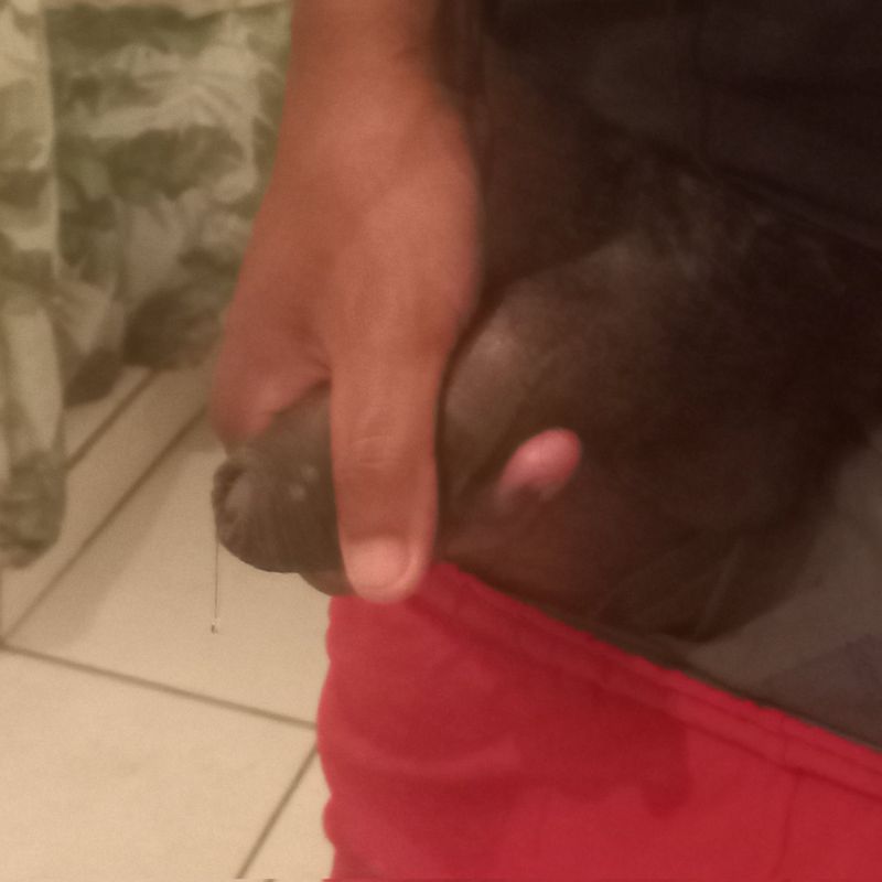 goteira diferente