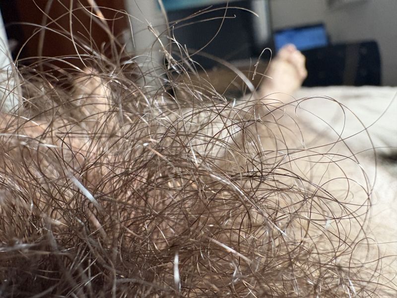 Detalhes da pentelhada